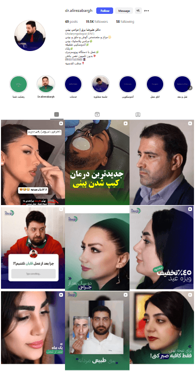 پیج اینستاگرام جراح بینی تهران دکتر برق
