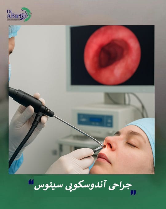 جراحی اندوسکوپی سینوس