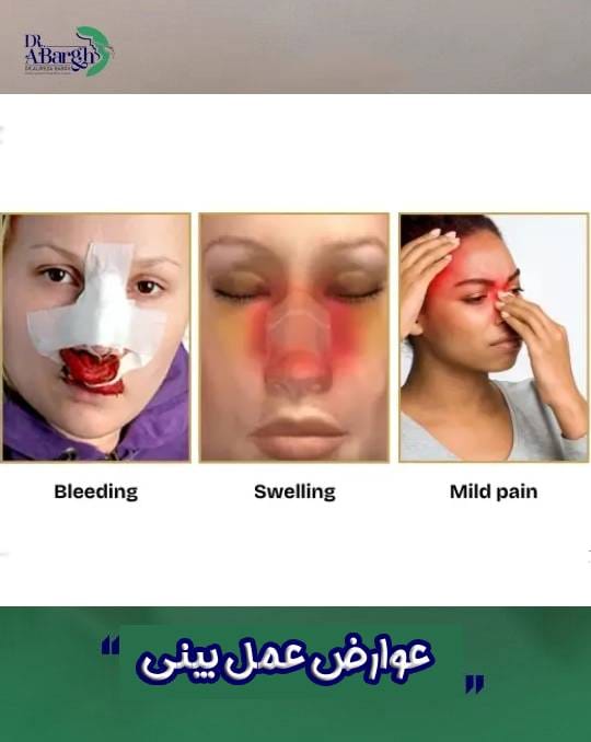 عوارض عمل بینی
