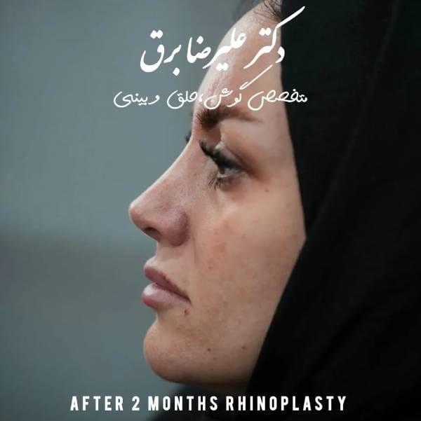 عکس عمل جراح بینی تهران