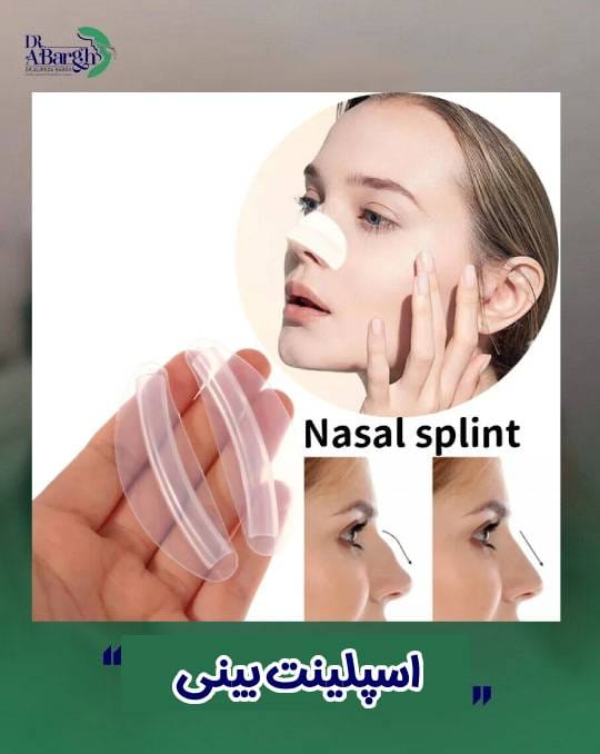 اسپلینت بینی