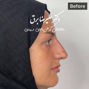 نمونه جراحی بینی
