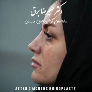عکس نمونه کار جراحی بینی